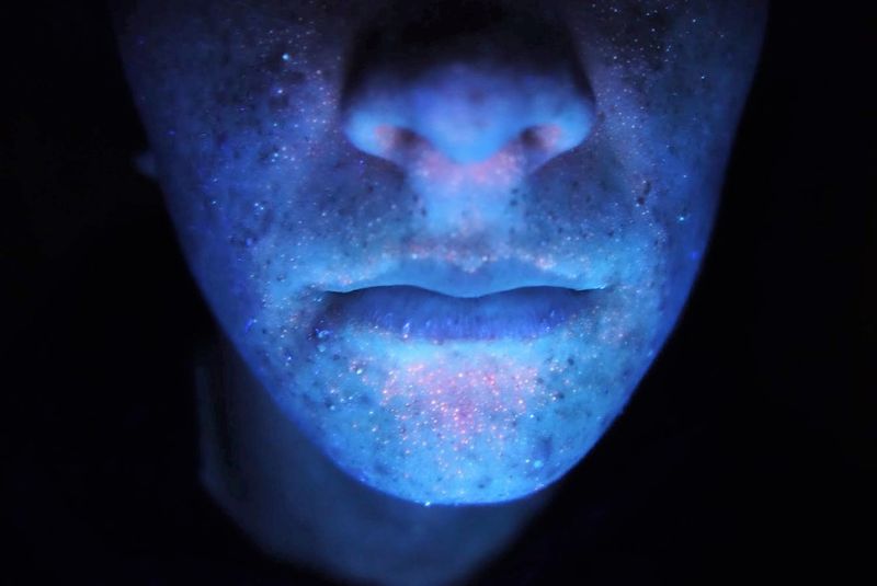 Diagnóstico facial con Luz de Wood