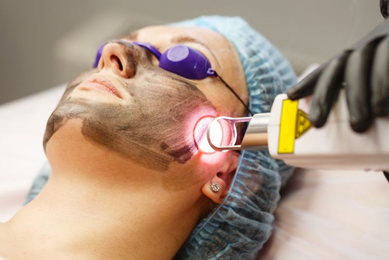 Diagnóstico facial con Luz de Wood